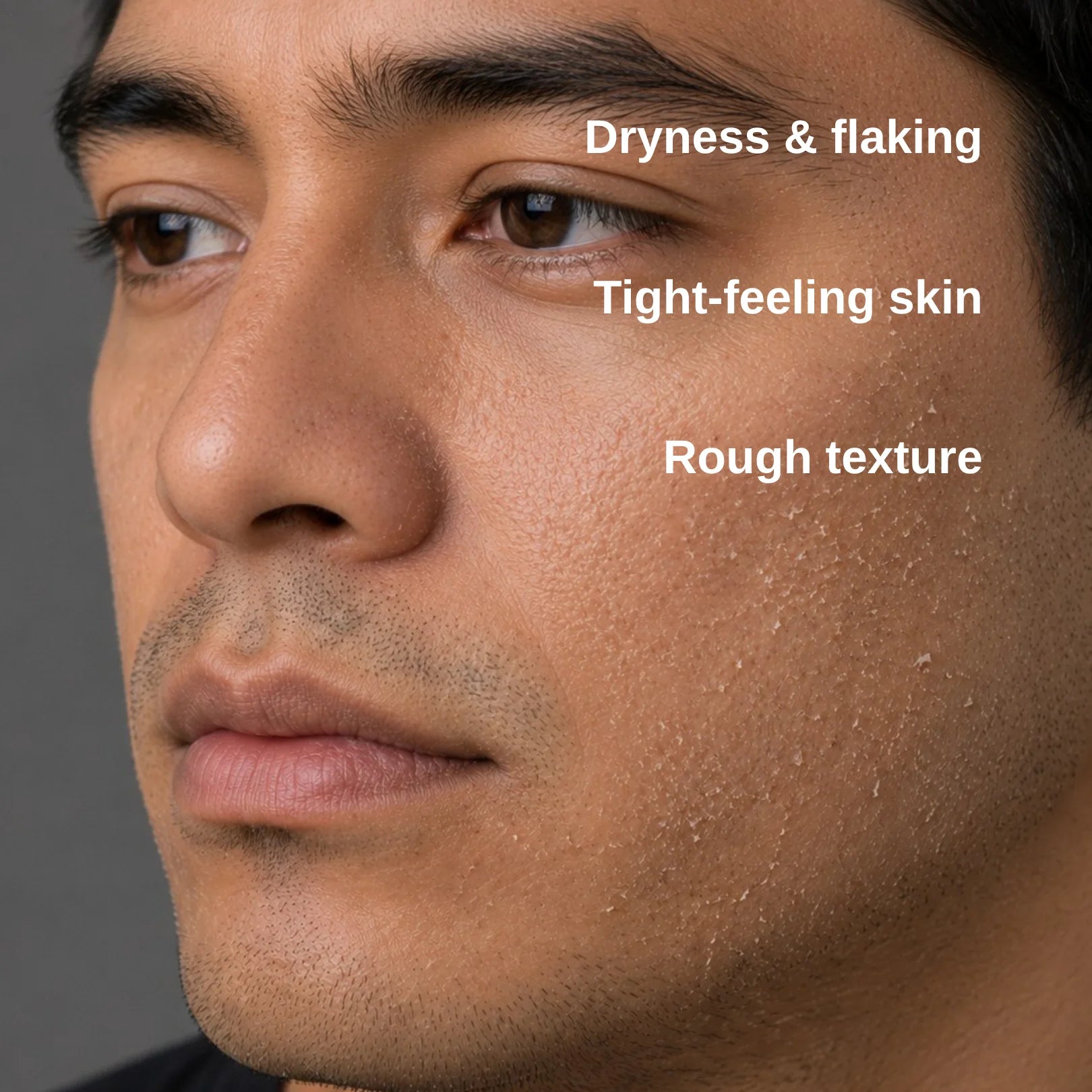 Close-up of a man's face showing dry, flaky skin texture with overlaid text reading 'Dryness & flaking', 'Tight-feeling skin', and 'Rough texture'.