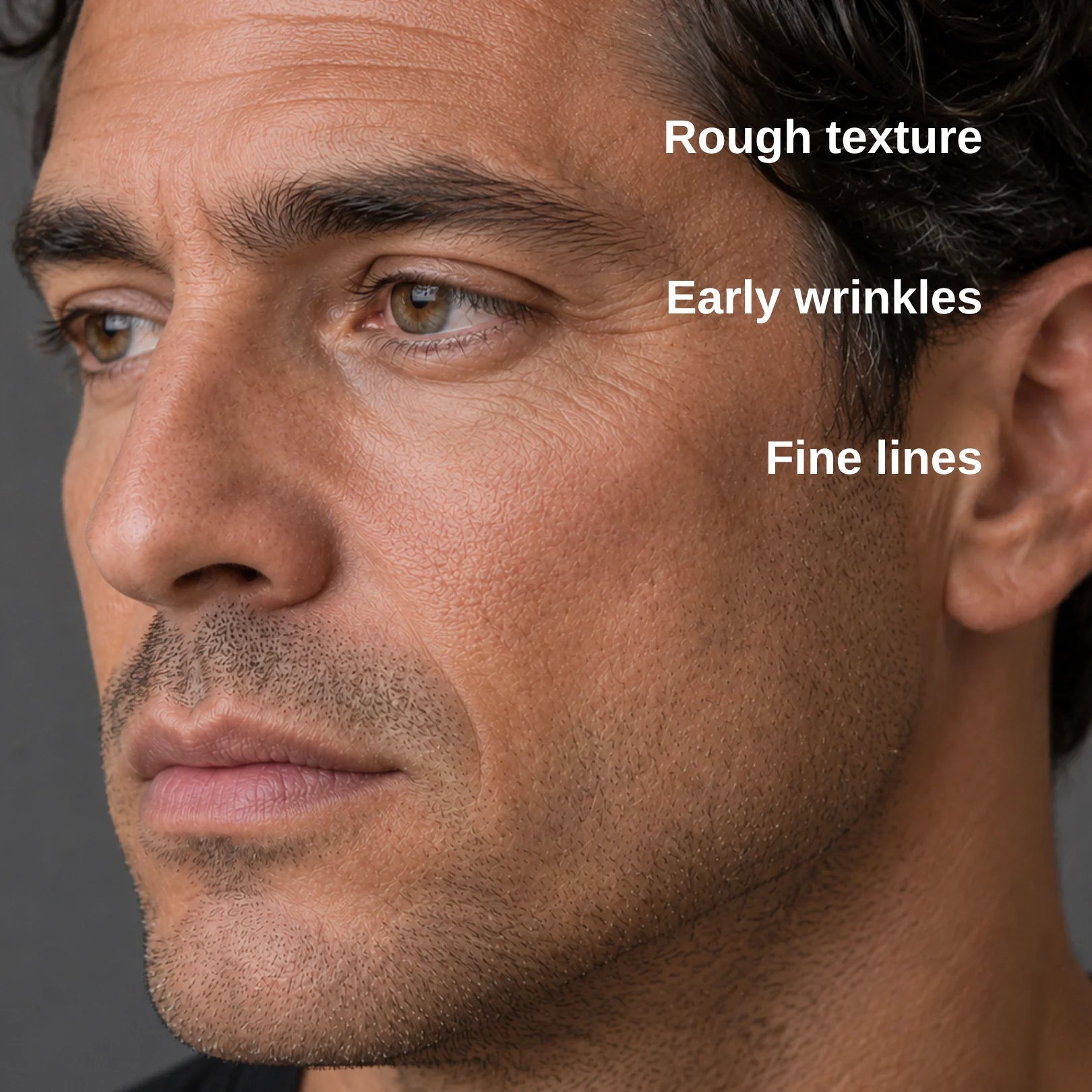 Close-up of a man's face with overlaid text reading 'Rough texture', 'Early wrinkles', and 'Fine lines' pointing to skin texture and wrinkles.