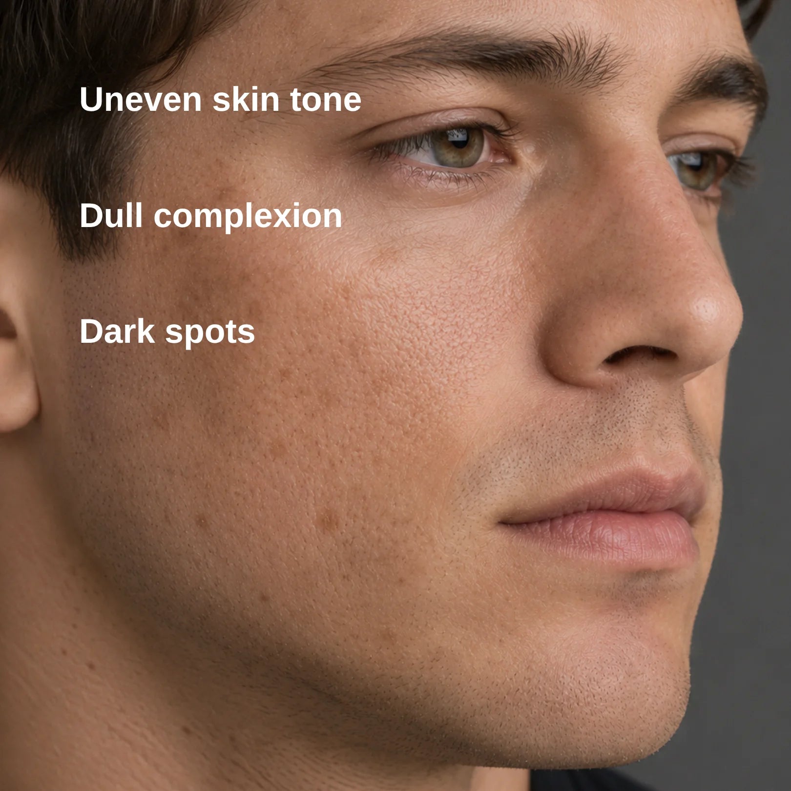 Close-up of a man's face showing skin texture and blemishes, with overlaid text reading 'Uneven skin tone', 'Dull complexion', and 'Dark spots' on a neutral gray background.
